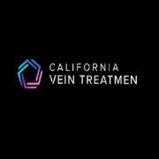 Vein Treatment California