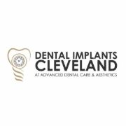 Dental Implants Cleveland